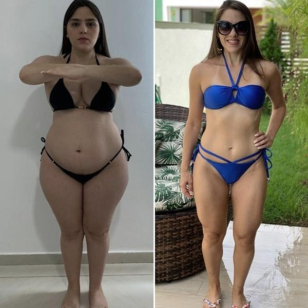 Antes y Después Ana