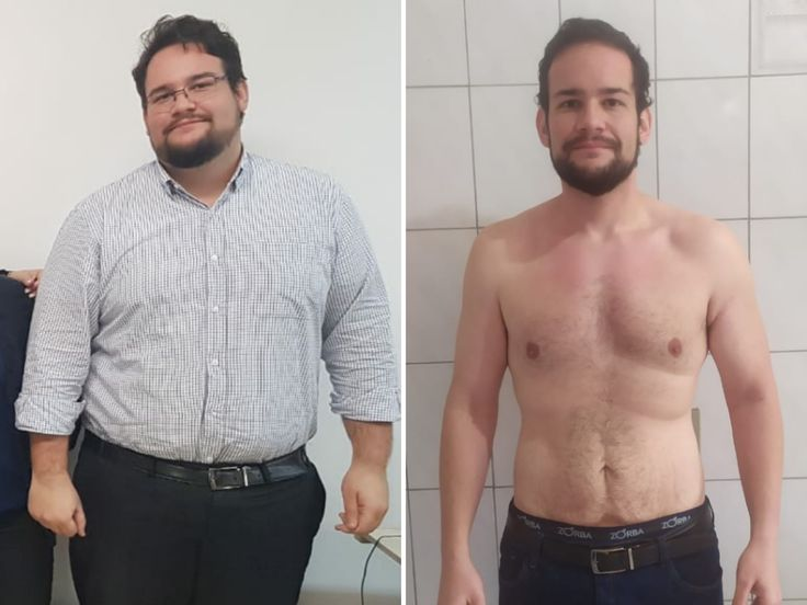 Antes y Después André