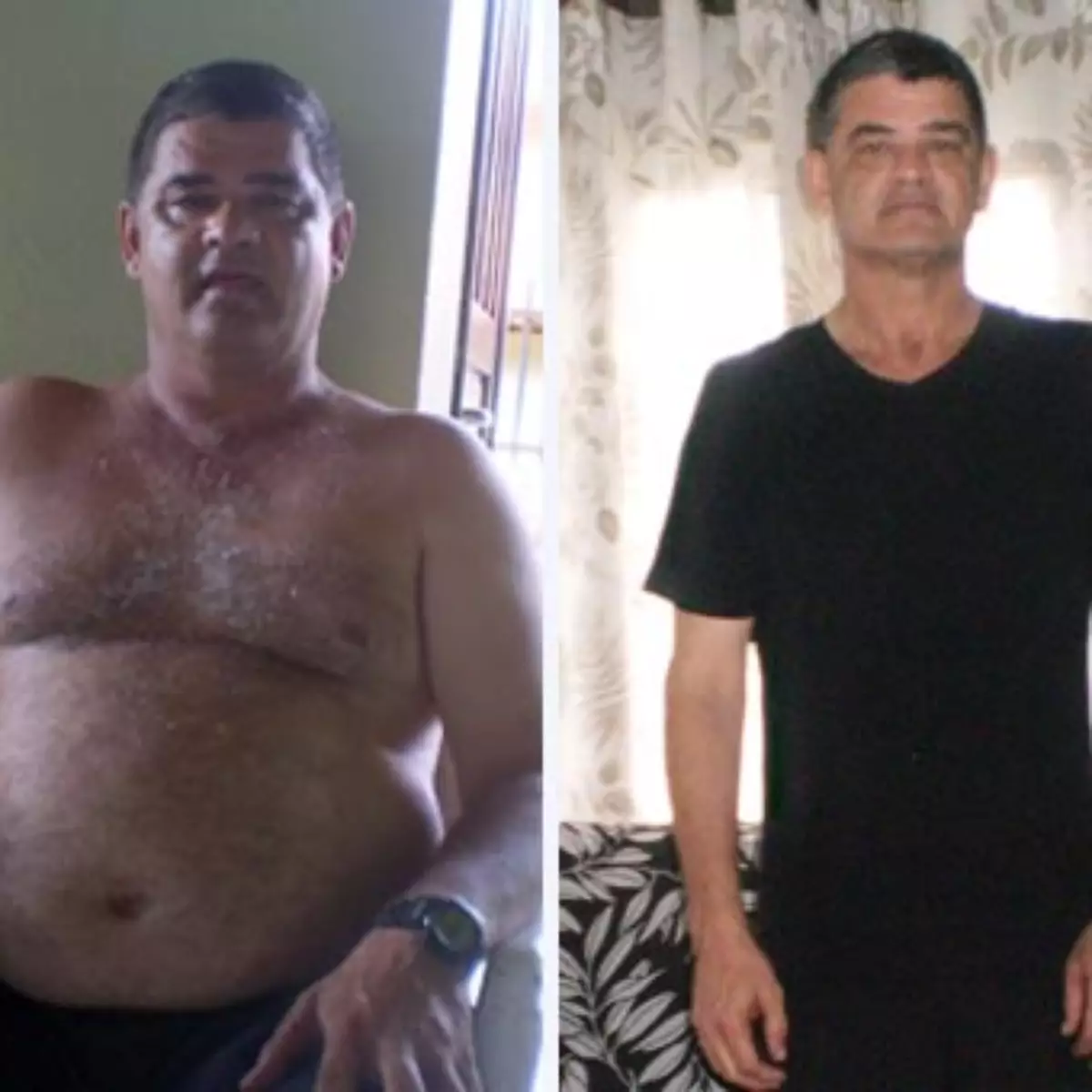 Antes y Después Carlos